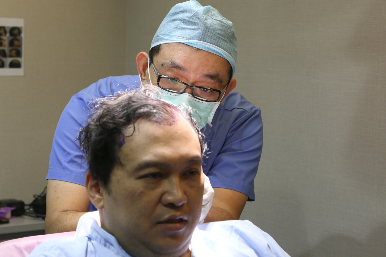 李定樊,楊名權,ARTAS,植髮機器人,植髮